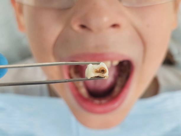 Best Pediatric Emergency Dentist in , ID
